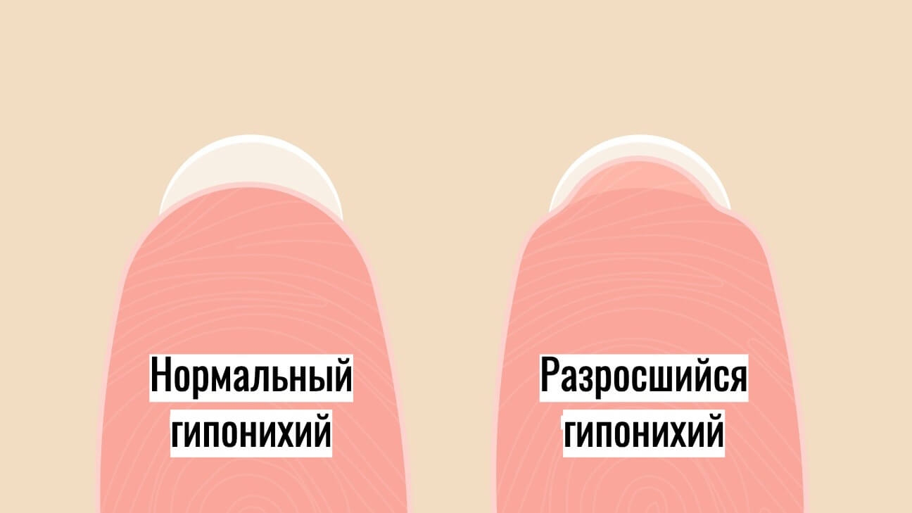 Стресс зона ногтя: читаем, сколько можно носить гель-лак