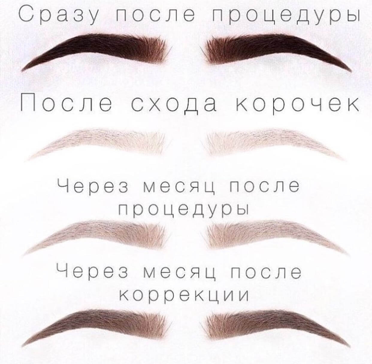 Этапы заживления перманентного макияжа бровей картинки