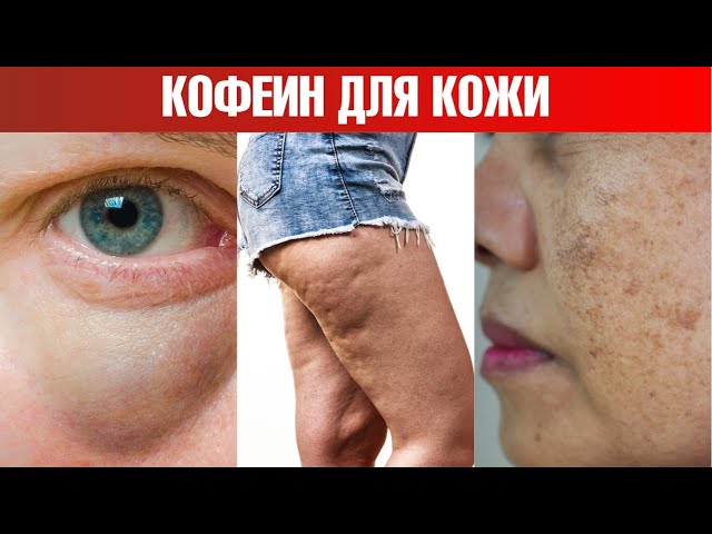 3 преимущества кофеина для кожи