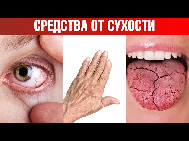 Сухость глаз, сухость кожи и сухость во ртупричины и решение