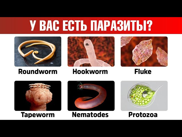 9 признаков паразитов в организме