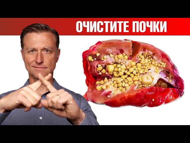 Очищение почек от оксалатов