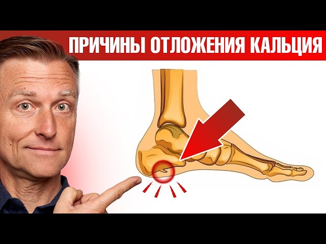 Главные причины отложения кальция в теле 