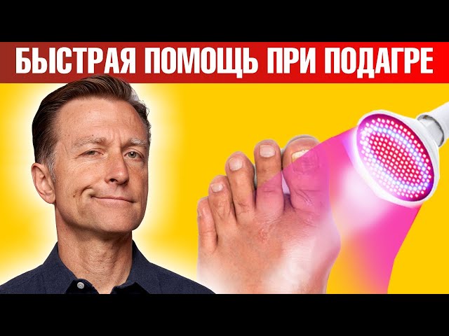 Терапия при подагре: безопасно и эффективно