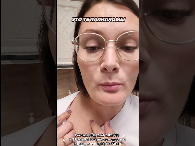 ‍Как избавиться от папилломы